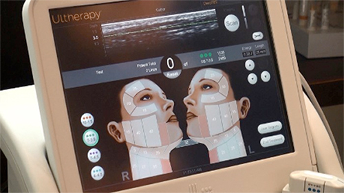 Ultherapy